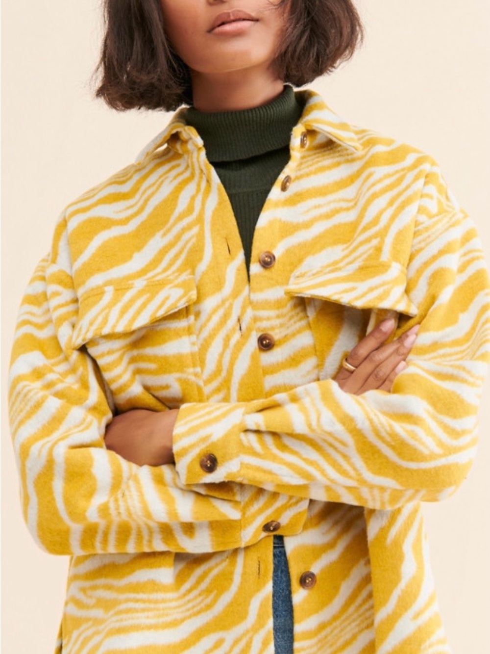 Yellow Zebra-Print Shacket - Picture 2 of 3